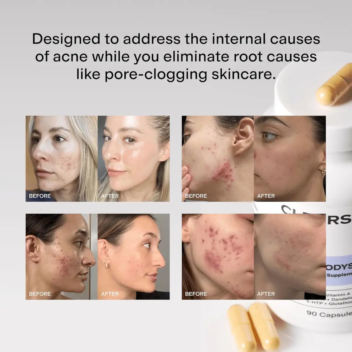 Clearstem MindBodySkin Suplemento para piel con imperfecciones 90 cápsulas - Hi Vitamins