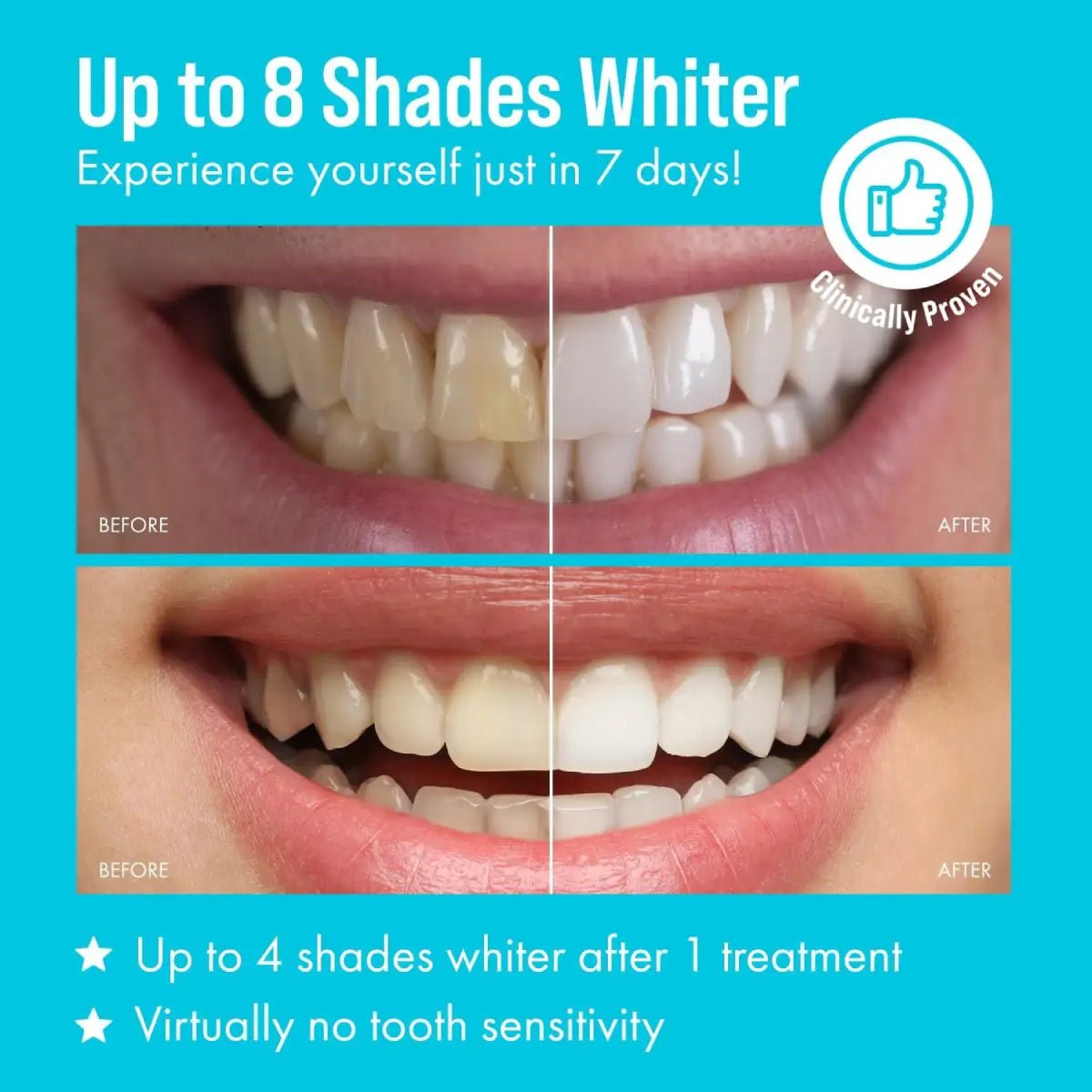 Cali White Deluxe Sistema de Blanqueamiento Dental - Hi Vitamins